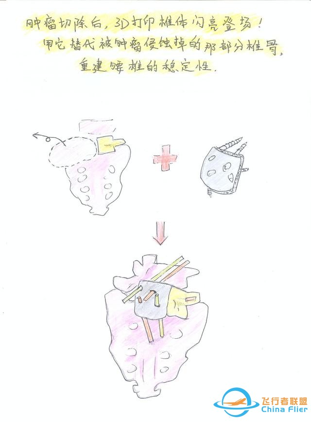 醫(yī)學(xué)領(lǐng)域的“AR 3D”技術(shù)究竟有多炫？10幅手繪漫畫給你講透-306